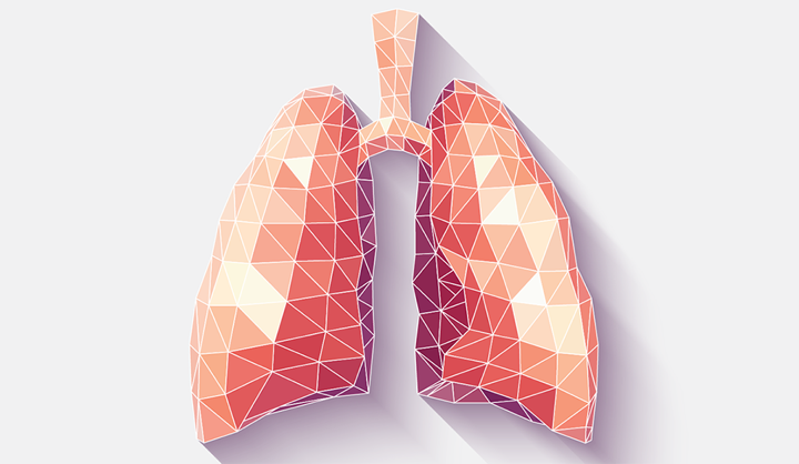 تا زمانی که خدمات منطقه به حالت عادی برگردند، ممکن است درمان بسیاری از افراد مبتلا به ویروس کرونا و درگیر با مشکلات ریه به تأخیر بیفتد.