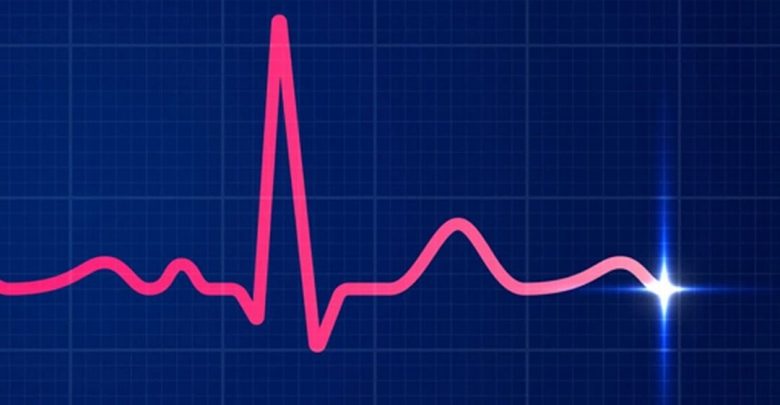 الکتروکاردیوگرام EKG یک آزمایش ساده و بدون درد است که فعالیت الکتریکی قلب شما را می‌سنجد.